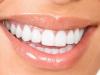 Những lưu ý khi tẩy trắng răng