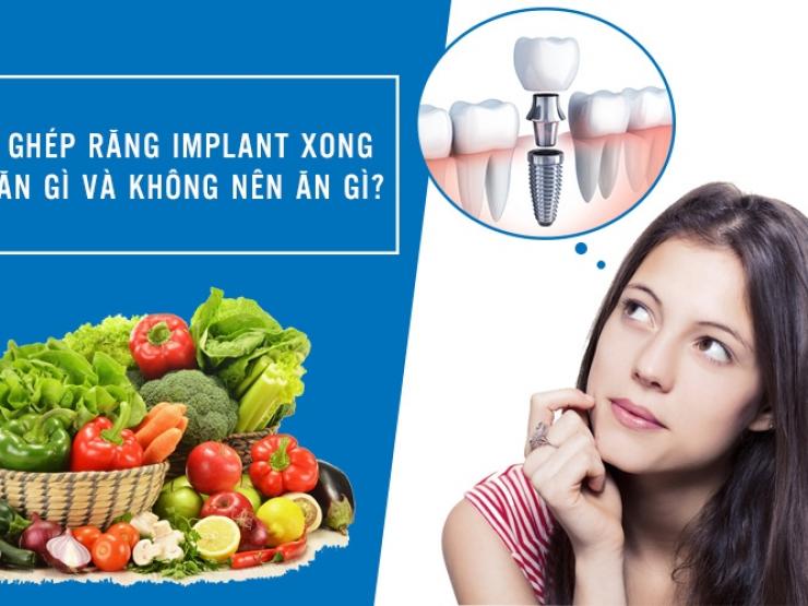 [KIẾN THỨC] Nên và không nên ăn gì sau khi cấy ghép implant